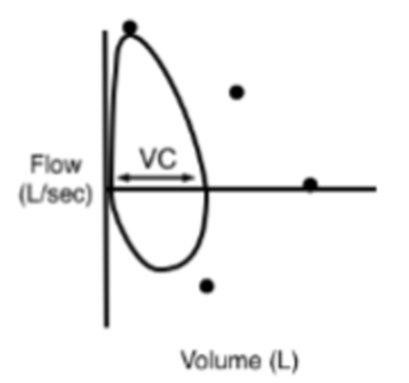 <p>Describe the pressure-volume loop and what it is most often associated with.</p>