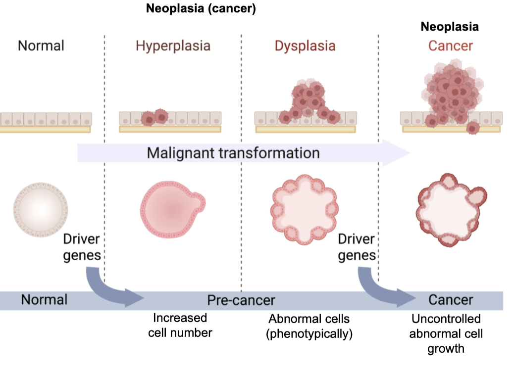 <ul><li><p><strong>Neoplasia = cancer</strong></p></li><li><p><strong>Benign:</strong> cannot invade other tissues</p></li><li><p><strong>Malignant:</strong> can invade other tissues</p></li><li><p>These terms mainly apply to <strong>solid tumours</strong> (not myeloid or B-cell cancers)</p></li><li><p><strong>Haematopoietic cancers:</strong></p><ul><li><p>Derived from non-adherent cells</p></li><li><p>Disseminate via <strong>blood and lymphatic systems</strong></p></li></ul></li><li><p><strong>“Acute” vs “chronic”</strong> → describes <strong>disease aggressiveness</strong></p></li></ul><p></p>
