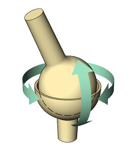 <p>what type of joint is this?</p>