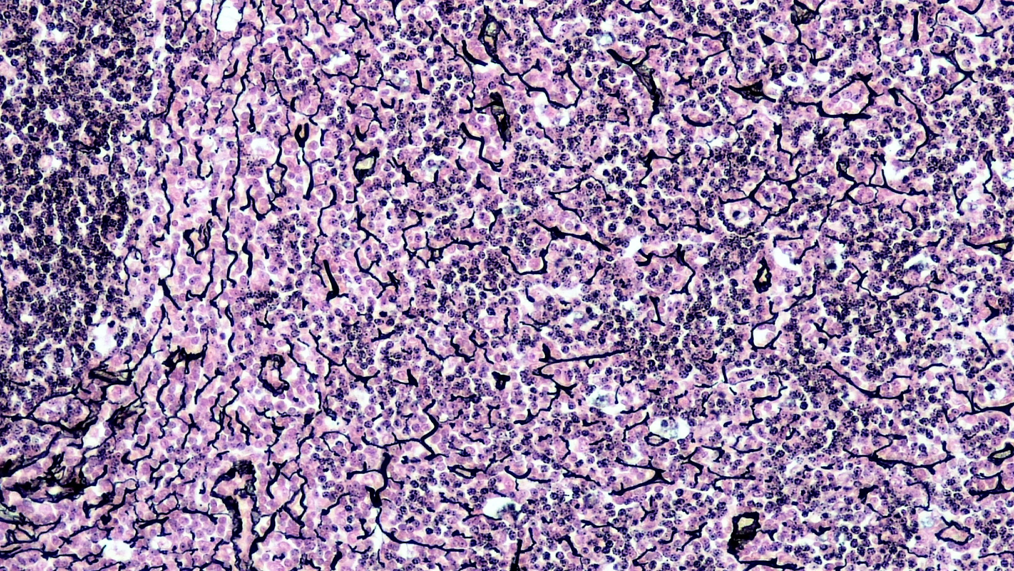 <p>Reticular Connective Tissue </p>