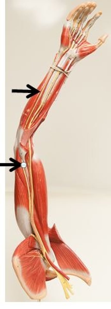 <p>Identify this nerve.</p>