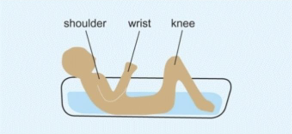 <p>the ‘bathtub’ rule</p><p>growth plates above the water line are the fastest growing</p>