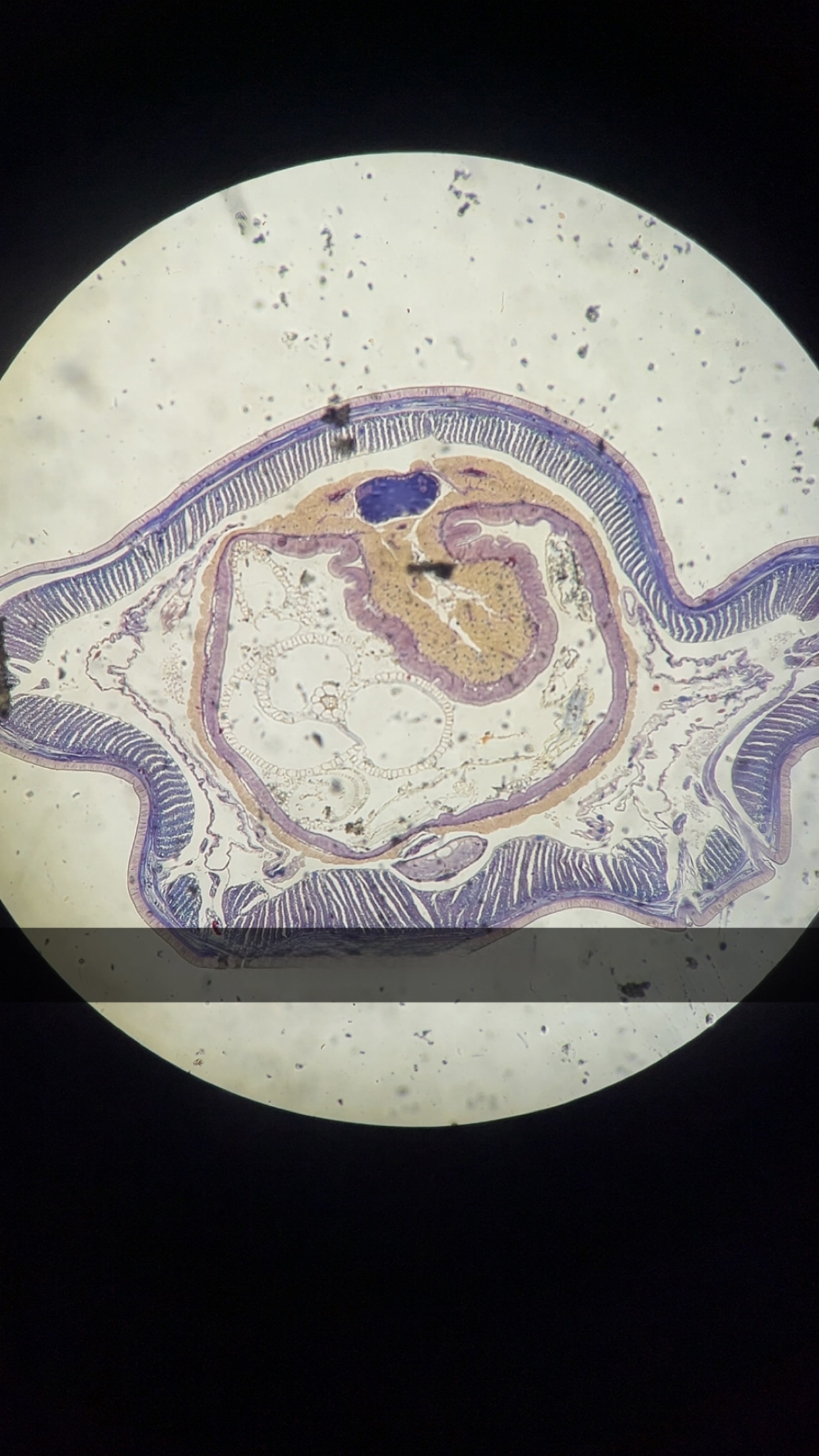 <p>What is this and what phylum </p>