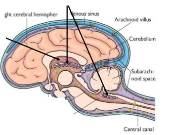 <p>Hjärnans ventrikelsystem. Vad är ventriklarna? Sammanhänger med vad? Vilka finns det? <br><br>Det svaga sträcket vid pilen till höger pekar på den nya</p>