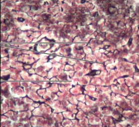 <p>Loose Reticular C.T.</p>