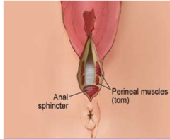 <p>Extends through perineal muscles</p>