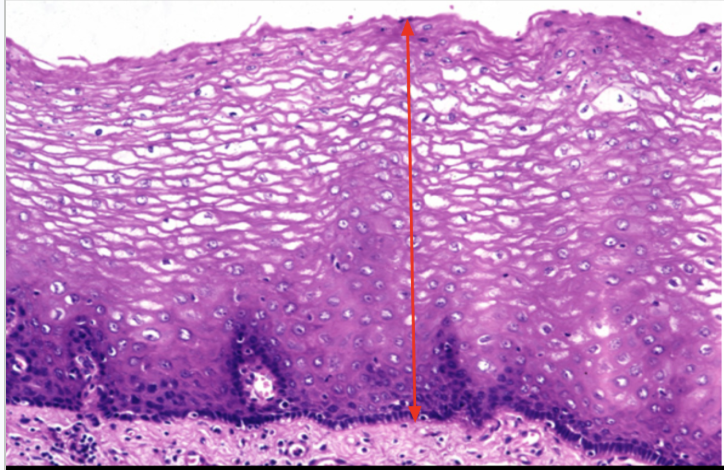 <p>Stratified squamous epithelium</p><p>Protection</p><p>Only found in the esophagus/mouth</p>