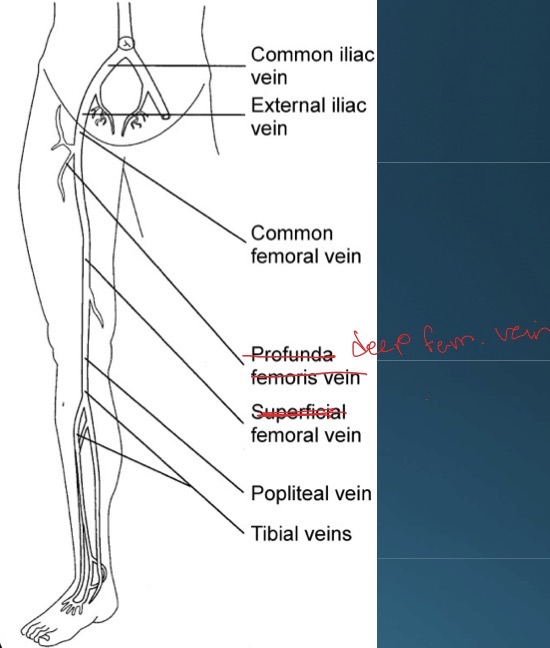 <p>Deep System: anterior tibial veins, posterior tibial veins, peroneal veins, popliteal vein, femoral vein, common femoral vein, deep femoral vein, external iliac vein, common iliac vein; most common anomalies are duplication of popliteal and/or femoral veins, duplication of distal segment of femoral vein, subsequently uniting to form single vein in mid proximal thigh, or presence of 3 or more tibial, popliteal, or femoral veins</p><p>left common iliac vein courses posterior to right iliac artery, accounting for higher incidence of left lower extremity deep vein thrombosis and swelling; normally, there’s no valves in common iliac veins</p>