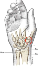 <p>What is this joint?</p>