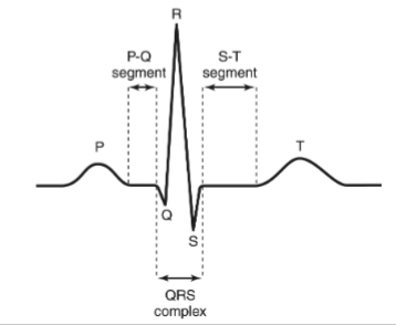 <p>Measure of electrical signals in depolarization and repolarization</p><ul><li><p>P wave: atrial depolarization, starts in SA node</p></li><li><p>QRS: ventricular depolarization &amp; atria repolarization</p></li><li><p>T wave: ventricular repolarization</p></li><li><p>P-Q segment: <span style="color: yellow;">atrial charge plateau but cardiac muscle cells of atria are contracting</span></p></li><li><p>S-T: ventricular charge plateau but cardiac muscle cells of ventricles are contracting</p></li></ul><p></p>