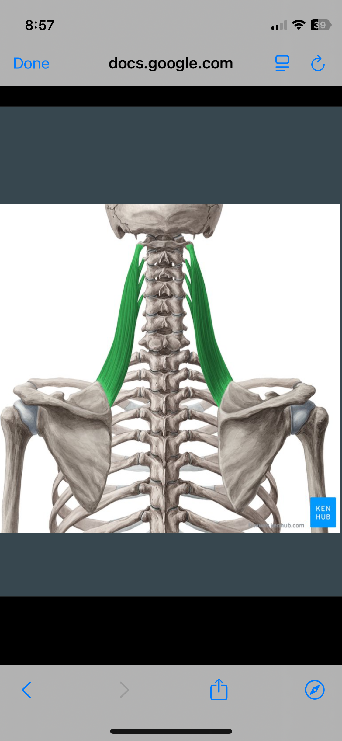 <p>Levator scapula</p>