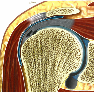 <p>Difficult to see on MRI and anthroscopically</p>