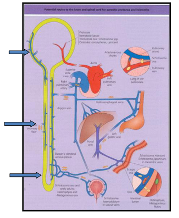 <p>ECTOPIC EGG GRANULOMAS</p><p>.</p><p>*Brain granulomas (epilepsy)</p><p>.</p><p>*Lungs - pulmonary (hypertension)</p><p>.</p><p>*spinal cord - paraplegia</p><p>*liver - fibrosis</p><p>*spleen - splenomegaly</p><p>.</p><p>*genitourinary tract (bladder cancer)</p><p>.</p><p>- occasionally eggs randomly go around body (not just liver)</p><p>- the above shows all the problems associated with this</p>