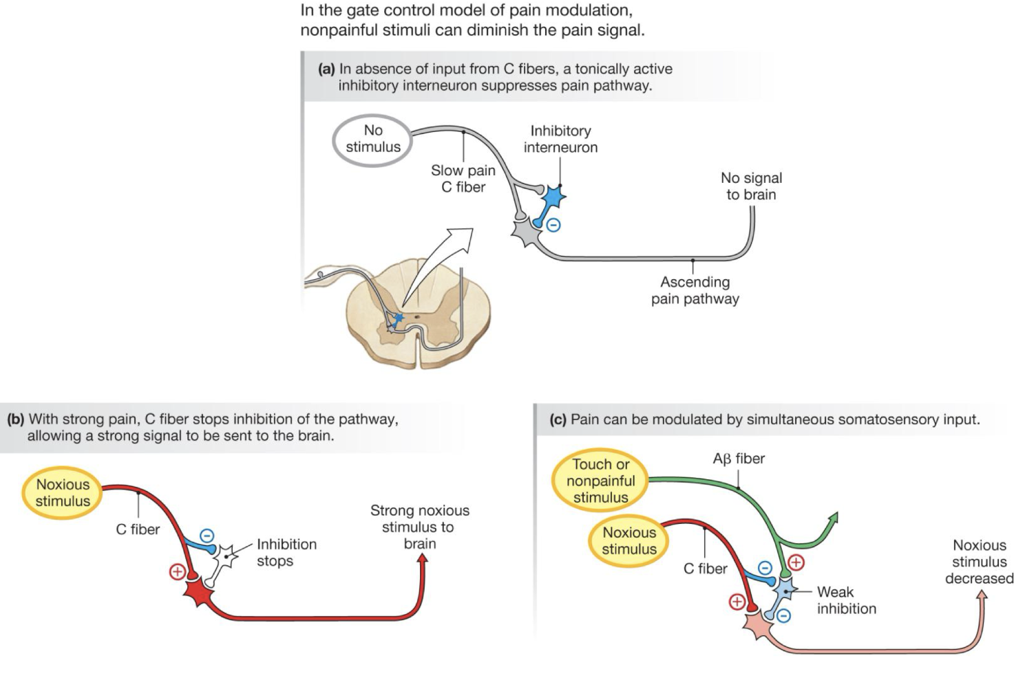 <ul><li><p><span><strong>Withdrawal Reflex</strong>: A polysynaptic spinal pathway snatching a limb from danger without waiting for the brain's input — <em>Example: Jerking your bare foot off a sharp rock before you consciously realize it hurts.</em></span></p></li><li><p><span><strong>Gate Control Theory</strong>: Spinal cord interneurons blocking nociception input when overwhelmed by overlapping mechanoreceptor signals — <em>Example: Vigorously rubbing your shin after banging it against a coffee table to dull the throbbing pain.</em></span></p></li></ul><p></p>