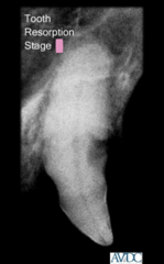 <p>what stage of tooth resorption is this?</p>