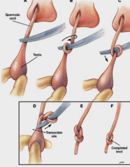 <p>What ligation techniques for feline castration is being shown?</p>