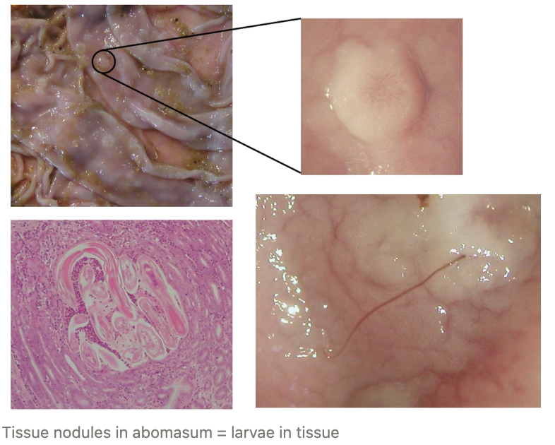 <p><u>Localisation:</u> Abomasum of cattle</p><ul><li><p>Most pathogenic worm of cattle</p></li></ul><p><u>Type I Ostertagiosis:</u></p><ul><li><p><strong>Signalment:</strong> Calves in mid - late winter</p></li><li><p><strong>Pathogenesis:</strong> High larval intake/high worm burden</p></li><li><p><strong>Diagnosis:</strong> FEC</p></li></ul><p><u>Type II Ostertagiosis:</u></p><ul><li><p><strong>Signalment:</strong> Yearling or 2yr cattle in spring</p></li><li><p><strong>Pathogenesis:</strong></p><ol><li><p>Cattle graze highly contaminated pasture in autumn</p></li><li><p>Accumulation of inhibited eL4 in gland crypts of the abomasum heading into winter (worsening climate) =<strong> Hypobiosis</strong> → No clinical signs</p></li><li><p>Larvae resume development in early spring → En mass emergence</p></li><li><p>Clinically affected cattle due to damage to abomasal mucosa</p></li></ol></li></ul><ul><li><p><strong>Diagnosis:</strong> Plasma pepsinogen assay (cannot diagnose with FEC as L4 cause disease NOT adults)</p></li></ul><p><u>Clinical Signs:</u> Diarrhoea, dehydration, bottlejaw, inappetence, weight loss and death</p>