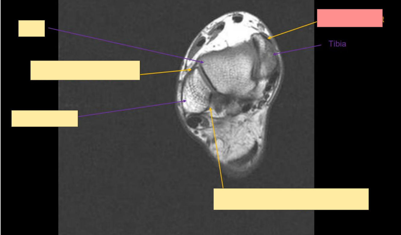 <p>Identify the structure</p>