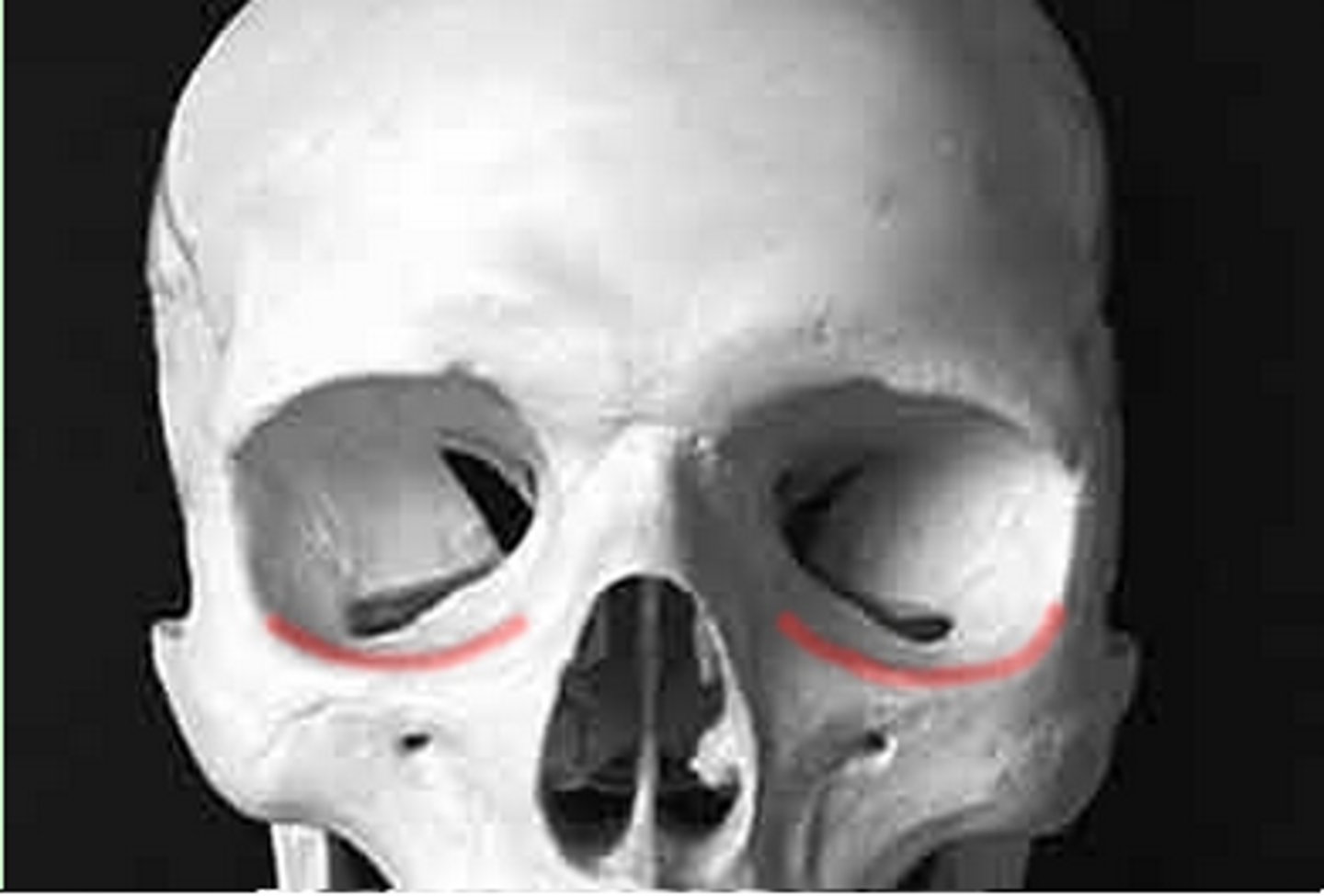 <p>What is this boney feature?</p>