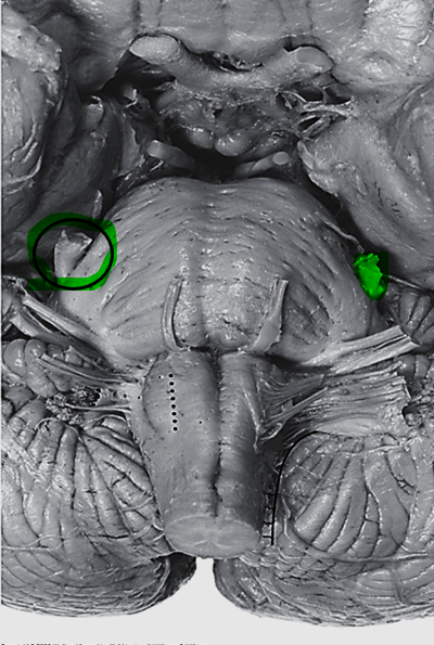 <p>Pierces through lateral pons</p><p><u>3 roots/divisions:</u> ophthalmic, maxillary, mandibular (O.M.M)</p>
