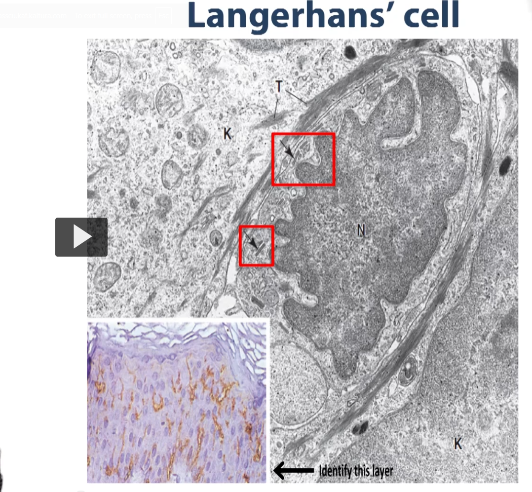 <p>Here you have a Langerhan cell. These are the cells of the skin that monitor the skin, and they are part of the antigen presenting system of the skin, we’ve used an antibody found on the surface of the Langerhans cell to illustrate them here in light microscopy and we’ve counterstained this cross section of skin with a H & E so you can see where the rest of the layers are where the Langerhans cells. You can see they are abundantly distributed throughout the stratum spinosum. monitoring for the presence of foreign pathogens, which is there function. </p>