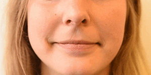 <p>Dimpler</p>