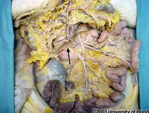 <p>what artery is pictured?</p>