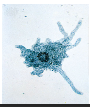 <p>Cell membrane surface, no cell wall = change shape</p><p>Psuedopods (cytoplasm extensions for feeding and movement)</p><p>Habitat: Salt water, fresh water, mud, intestines</p><p>Ex. Amoeba</p><ul><li><p>Single celled</p></li><li><p>No body shape</p></li><li><p>Contain pseudopods (to move and eat)</p></li><li><p>Eat by endocytosis</p></li></ul><p>Ex. Trypanosoma</p><ul><li><p>flagellated protozoa</p></li><li><p>cause tropical diseases in humans and animals</p></li><li><p>Trypanosomes are found in the bloodstream of various mammalian hosts where they proliferate as extracellular parasites</p></li></ul><p></p>