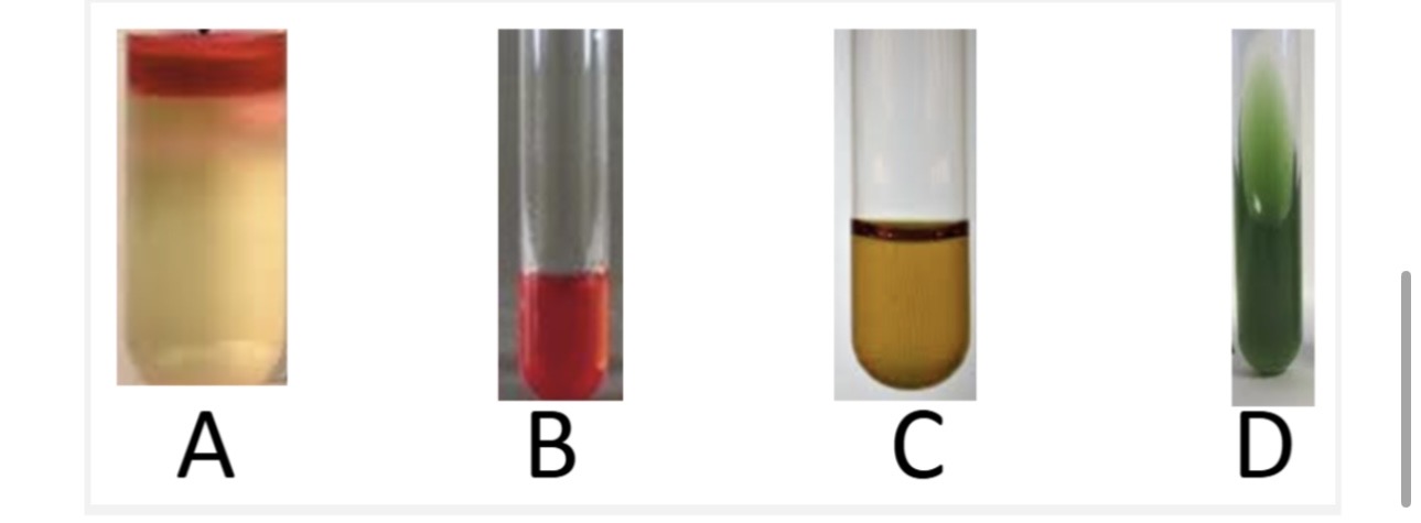 <p>On the second day E Coli was assumed and on the third day 4 tests determined that it was:</p><p>A. What is Test tube A? </p><p>B. What is Test tube B? </p><p>C. What is Test tube C? </p><p>D. What is Test tube D? </p><p>E. Could this be Escherichia Coli? </p>