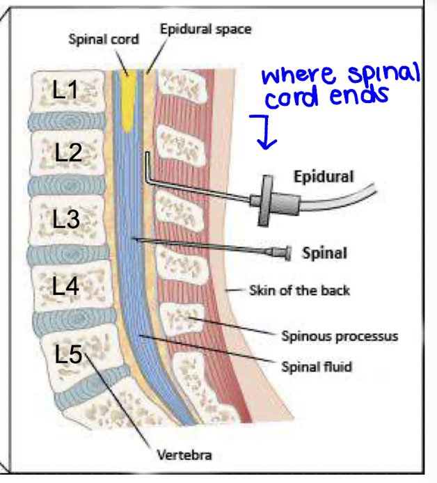 <p>It must be injected below the L2 vertebra to avoid damaging the spinal cord, which typically ends above this level.</p>