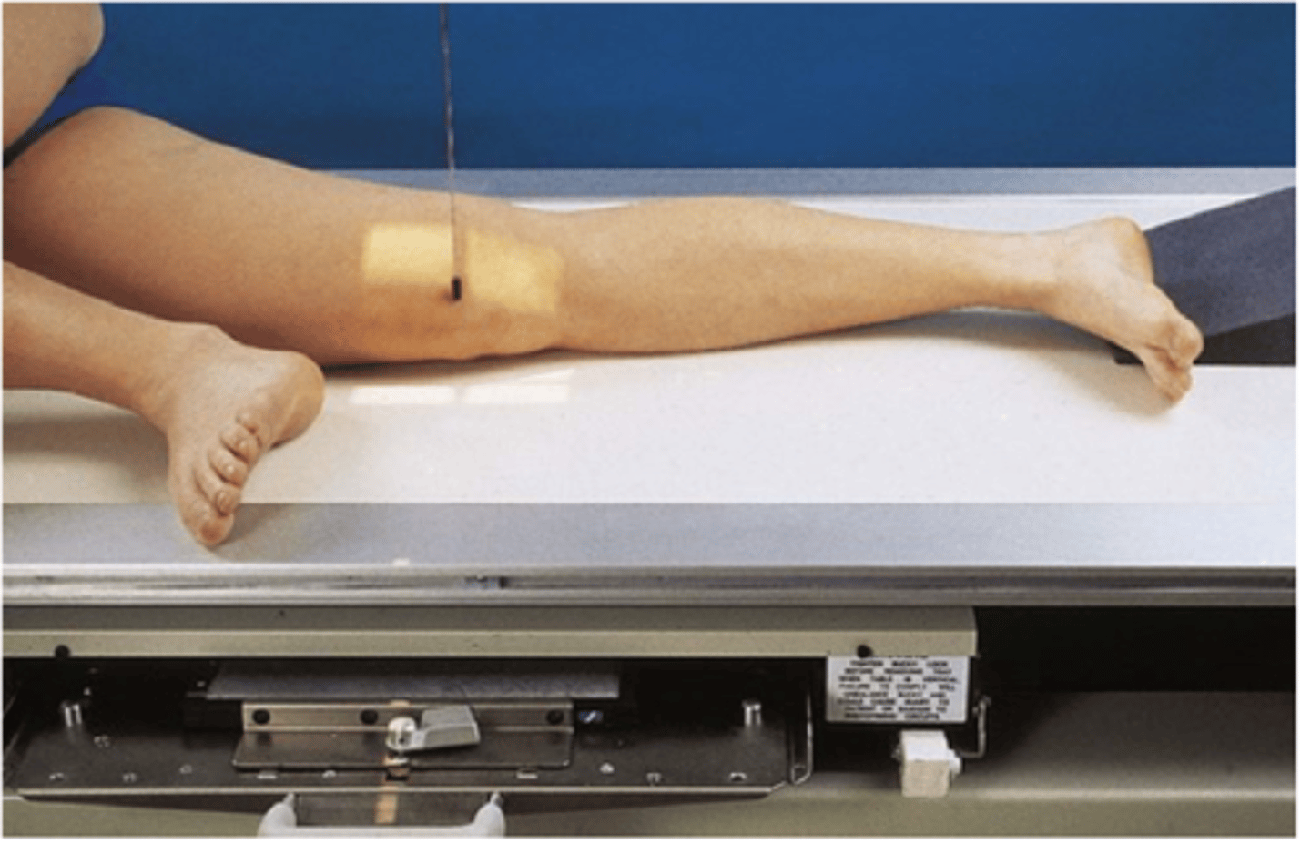 <p>S - over hip</p><p>T - 5 mAs @ 60 kVp</p><p>A - none</p><p>M - on cassette</p><p>P - PT on side w/ non imaged leg kicked over, CR to joint space</p><p>S - 40"</p><p>B - suspension</p><p>C - 10 x 12 lengthwise</p>