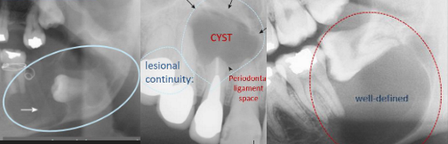 <p>odontogenic cysts? tumors?</p>