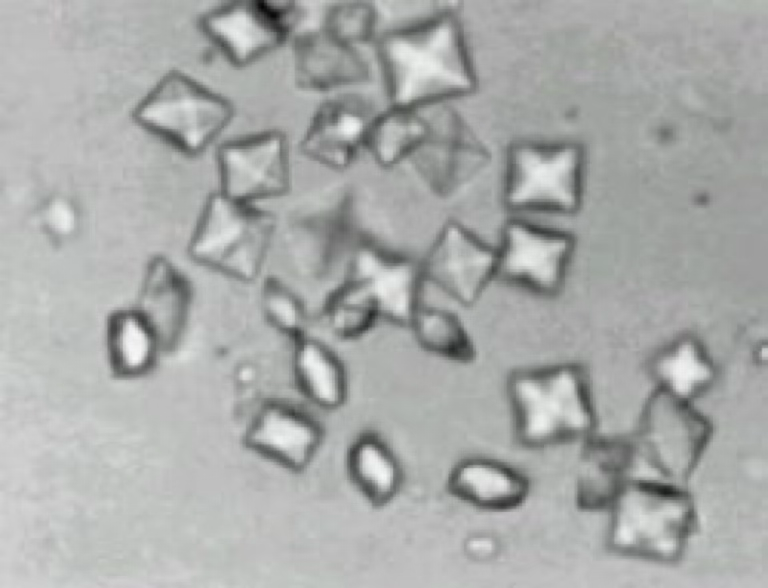 <ul><li><p>Resemble the back of an envelope, or the “xbox” logo.</p></li><li><p>Small number is commonly seen in dogs and horses.</p></li></ul><p></p>