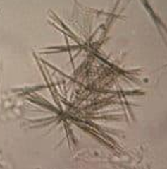 <p>Tyrosine Crystals</p>