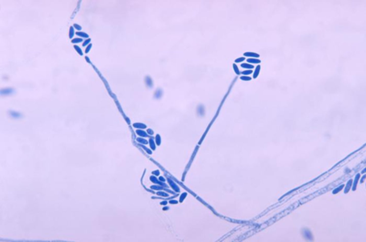 <p>Long delicate conidiophores</p><p>Balls of elliptical conidia</p>