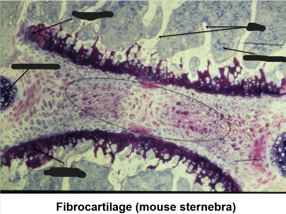 <p>sternebra</p>