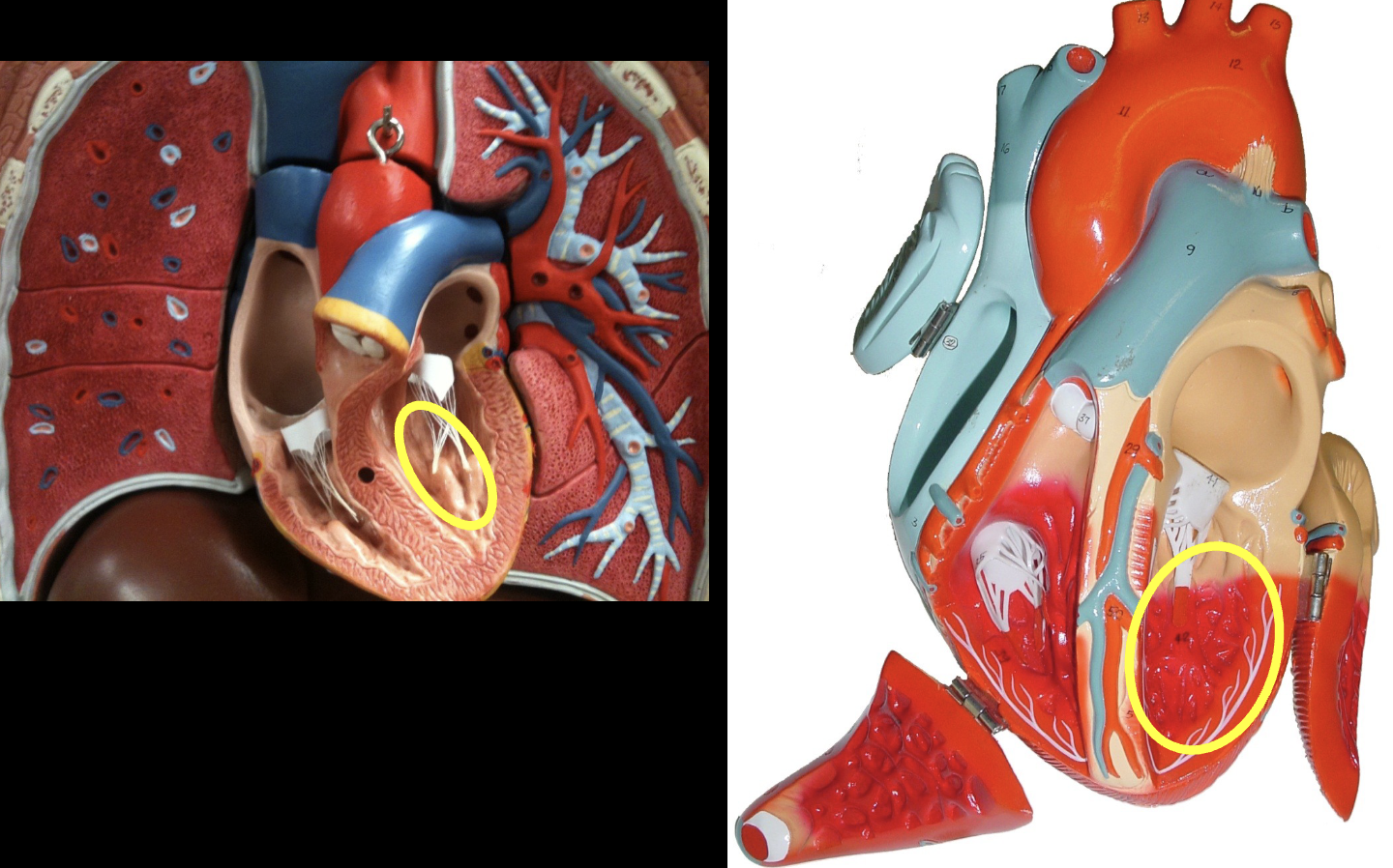 <p>what part of the heart muscle is shown?</p>