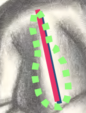 <p>Base; Tip (think ok a bowling pin)</p>