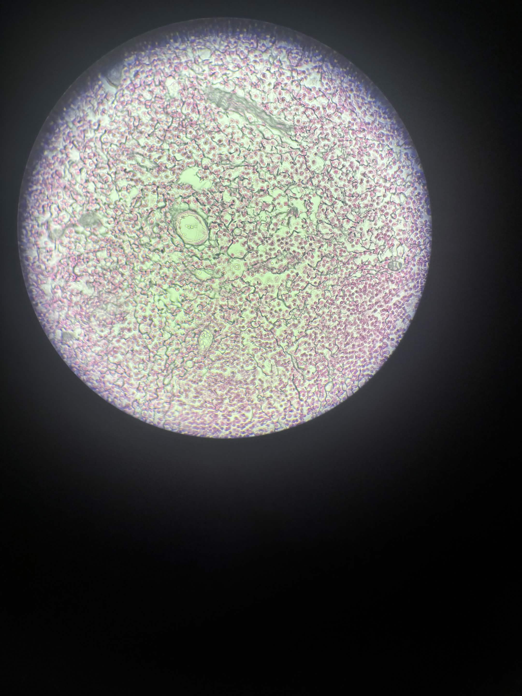 <p>Primary, Specific, Function, Location</p>