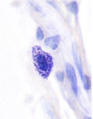 <p>Identify</p>