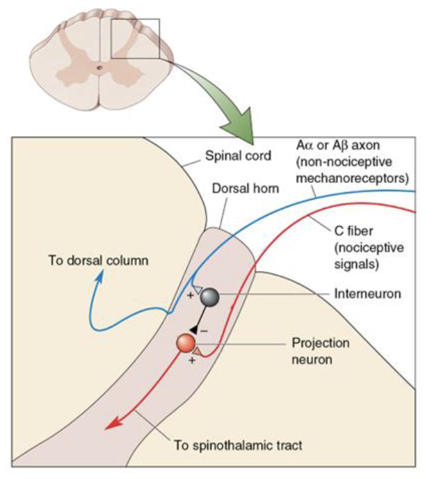 <p>Pain can be reduced by the activity of mechanoreceptors</p><p><strong><u>Gate control theory of pain</u></strong></p><ul><li><p>Neurons in the spinothalamic tract may be inhibited by A<span>α</span> or <span>Aβ </span>sensory nerves (touch) in the dorsal horn of the spinal cord.</p></li></ul><p></p>