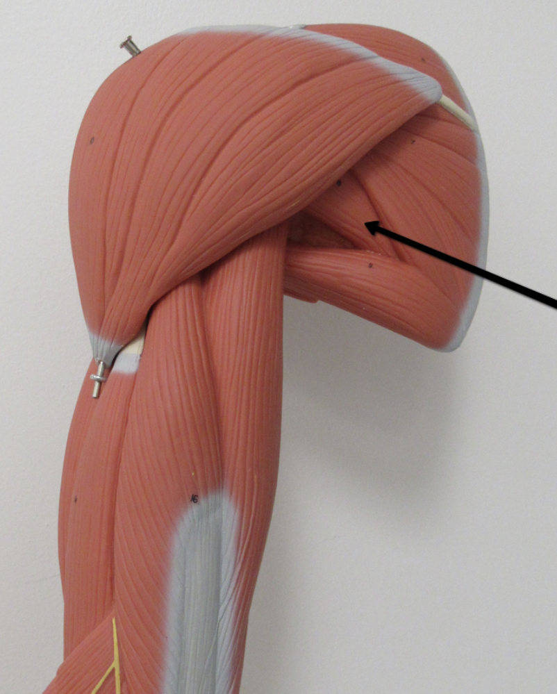 <p>Identify the muscle indicated by the pointer.</p>