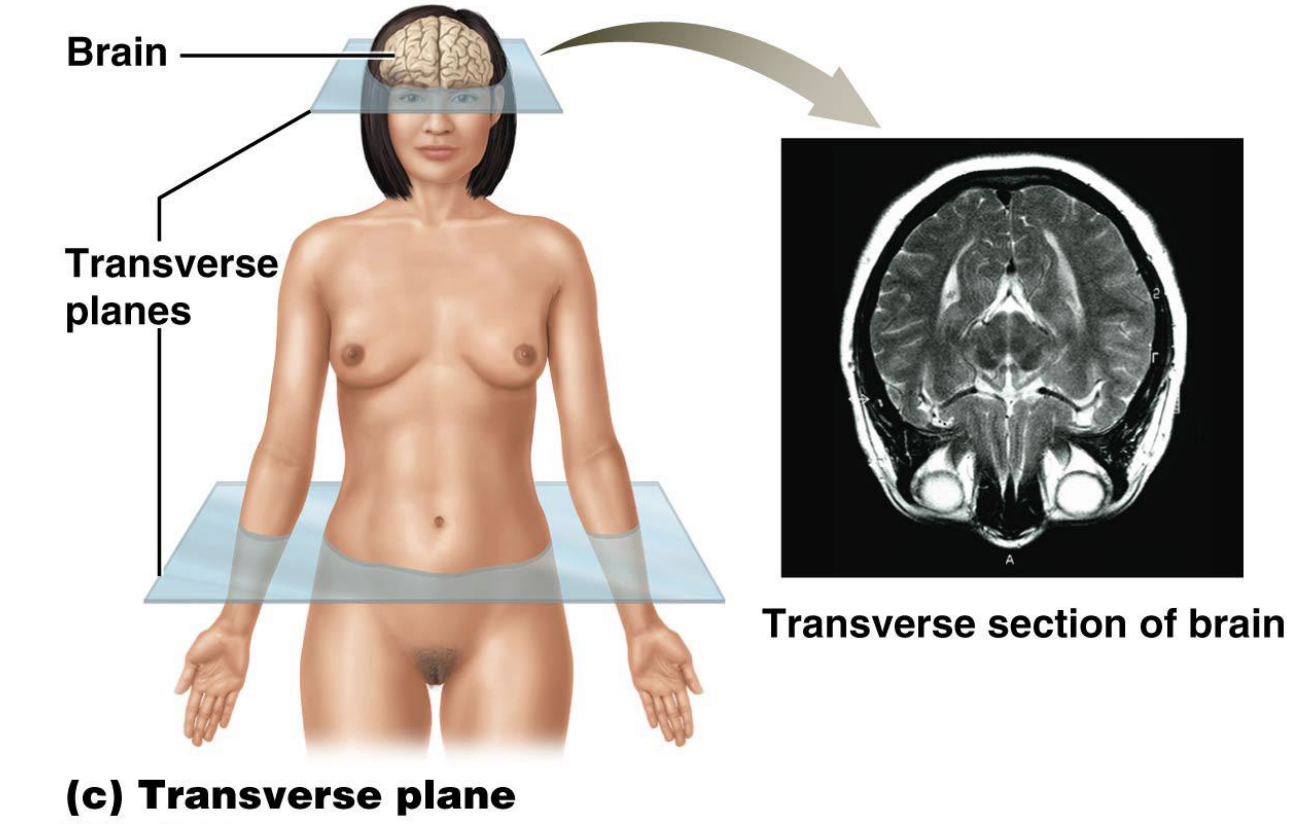 <p>Divides body or body part into superior and inferior sections or proximal and distal sections when describing structures of appendicular region</p>