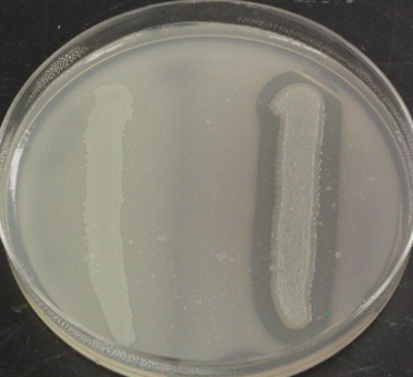 <p>Interpret the result of <strong>Lipid Hydrolysis</strong> shown in the image. </p>