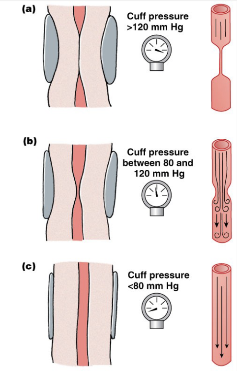<ul><li><p>Measuring blood pressure</p></li><li><p>High pressure blocks flow</p></li><li><p>slowly release pressure</p></li></ul><p></p>