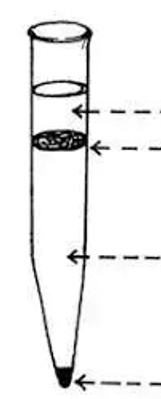 <p>Name the parts in FECT</p><p></p>