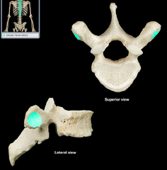 <p>ID the smooth structure</p>