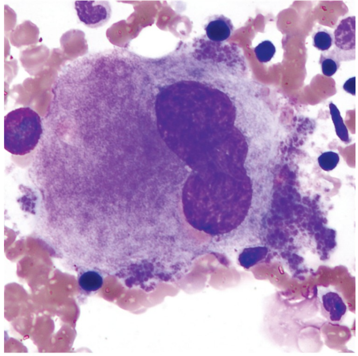 <p>what is mature megakaryocyte?</p>