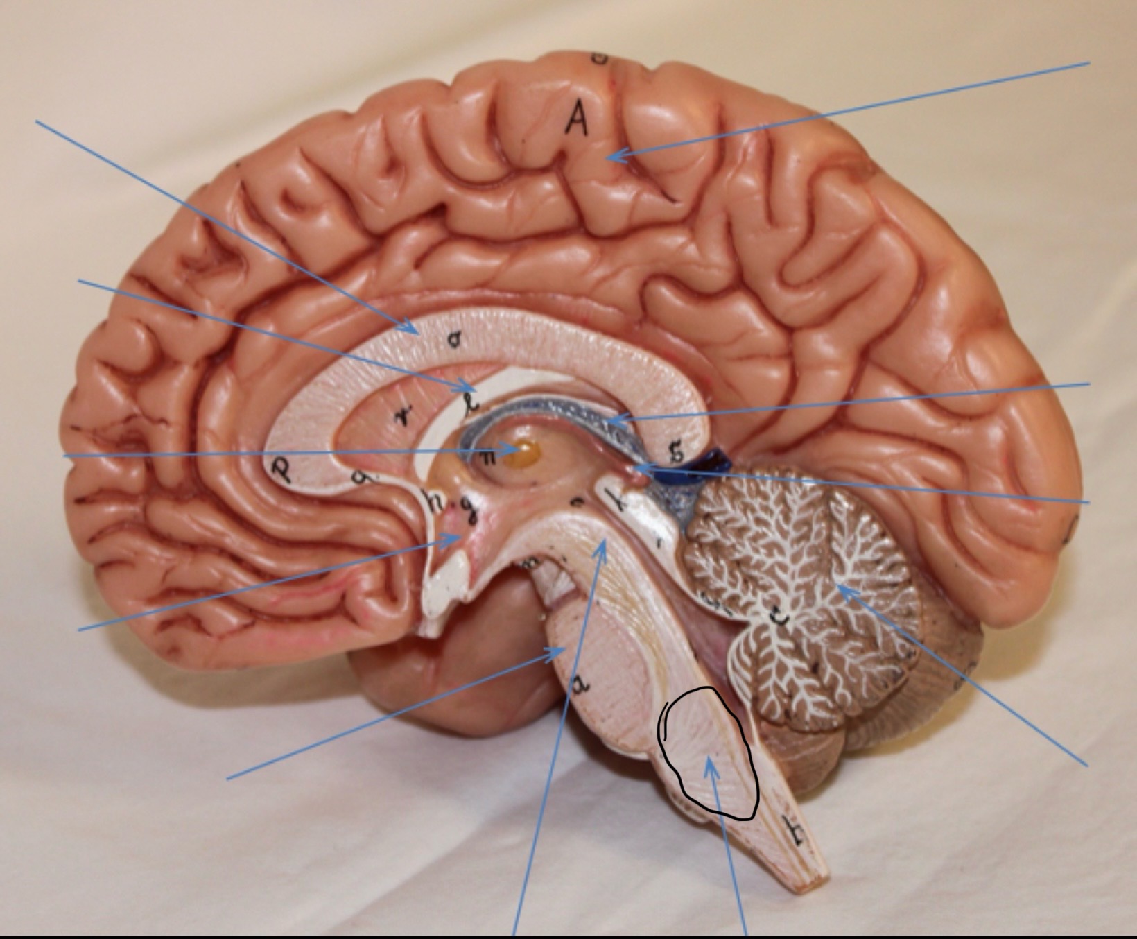 <p>Identify the circled area?</p>
