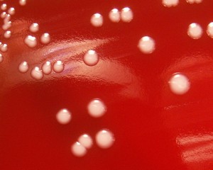 <ul><li><p><u>colony morphology</u></p><ul><li><p>medium colonies that are white-gray, creamy, raised, and <strong>gamma-hemolytic</strong></p></li></ul></li><li><p>coagulase-negative, catalase-positive</p></li><li><p>DNase negative</p></li><li><p><strong>novobiocin susceptible</strong></p></li></ul><p></p>